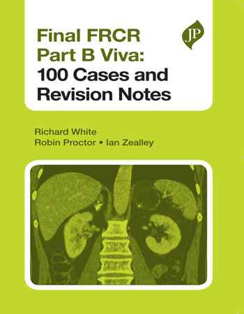 Final FRCR Part B Viva 100 Cases and Revision Notes